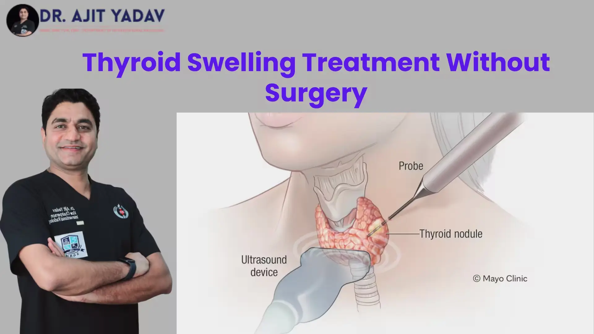 Thyroid-Swelling-Treatment-Without-Surgery