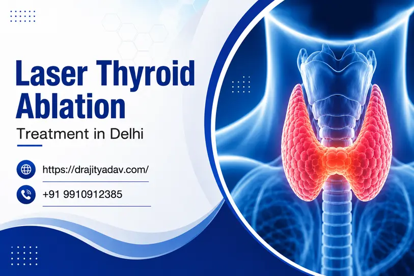 Laser Thyroid Ablation Treatment in Delhi