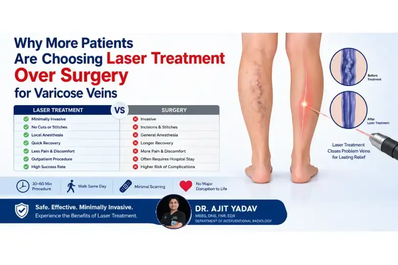 Why More Patients Are Choosing Laser Treatment Over Surgery for Varicose Veins