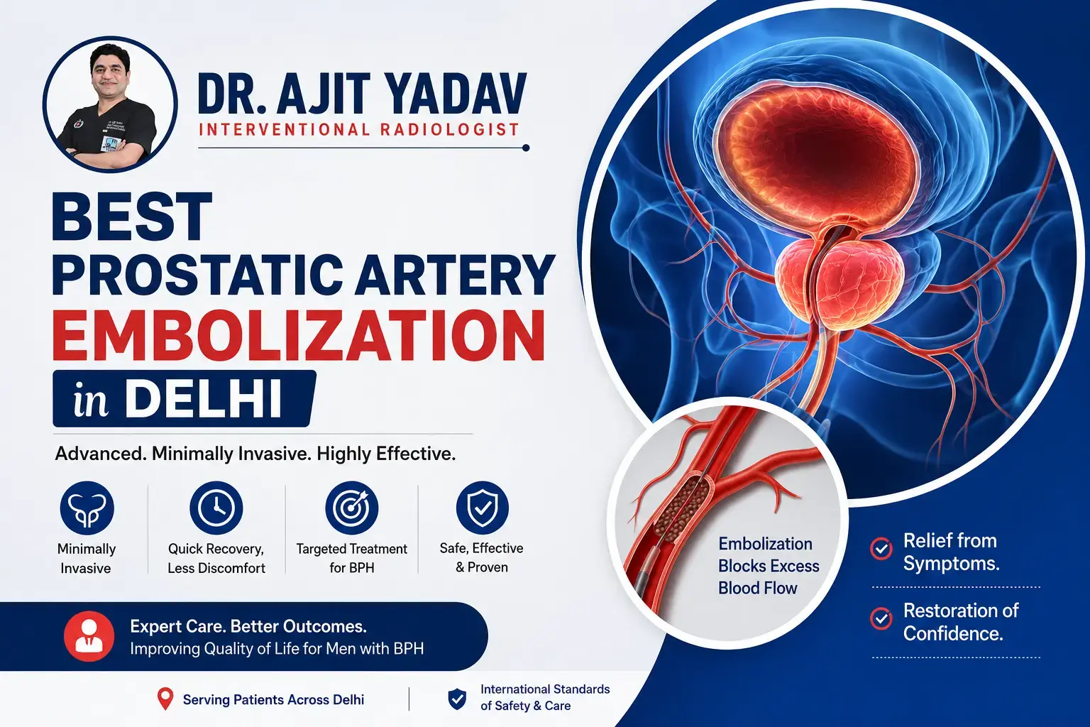 Best Prostatic Artery Embolization in Delhi