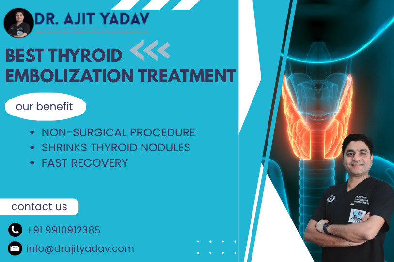 Thyroid Embolization Treatment in Delhi