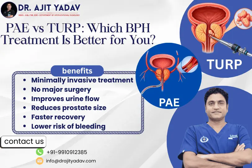 PAE vs TURP: Which BPH Treatment Is Right for You?