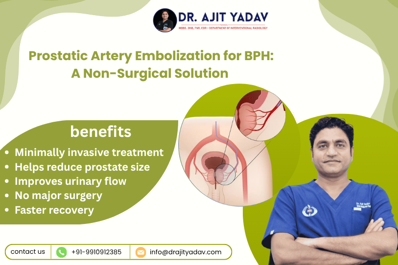 Prostatic Artery Embolization for BPH