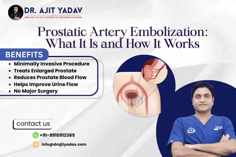 Prostatic Artery Embolization: How It Works